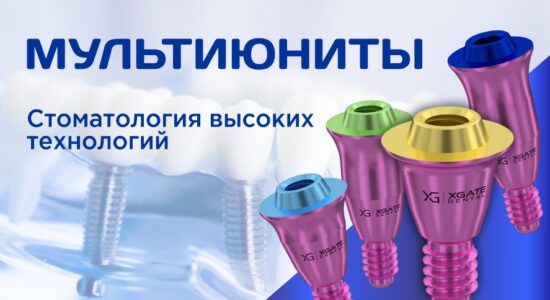 Обложка для статьи Стоматология высоких технологий